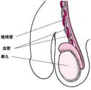 输精管不通的检查时间一般在什么时候