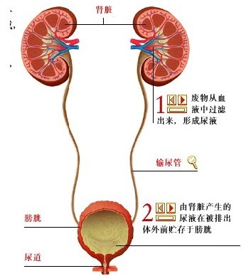 尿结石病因