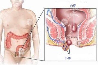 肛门疼痛怎么了