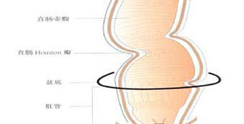 地沟油当心直肠恶变的危害